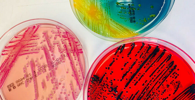 A identificação confiável de germes cultivados é essencial na análise bacteriológica clínica.